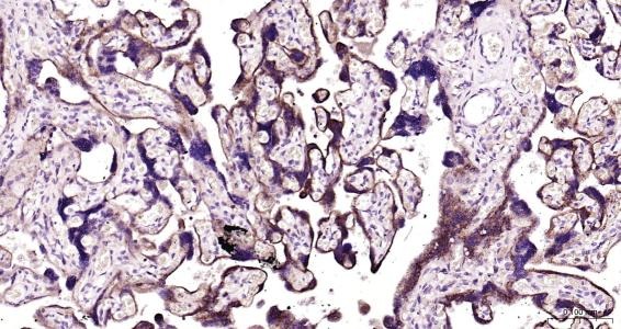 Anti-LAMP2 Polyclonal Antibody