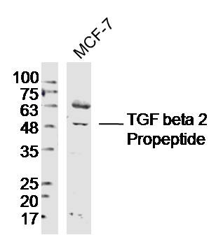 Anti-Latent TGF-beta 2 Polyclonal Antibody