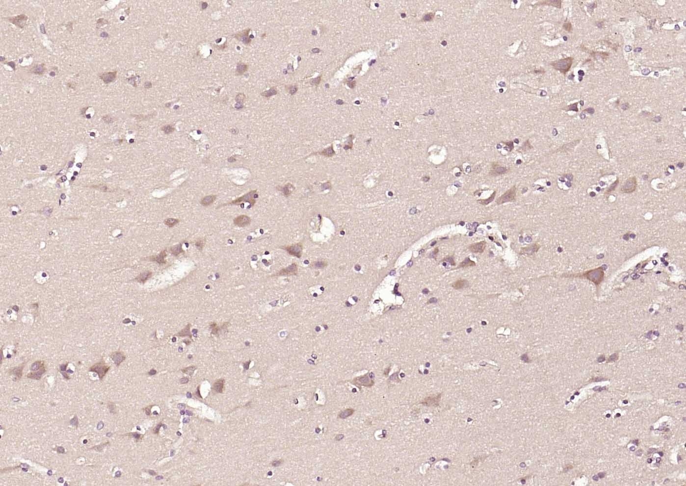 Anti-MFN1 Antibody (5U87)