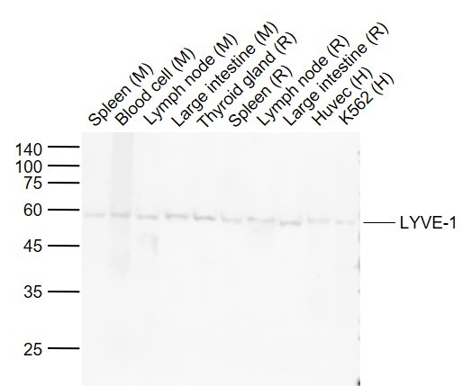 Anti-LYVE1 Antibody (7P115)