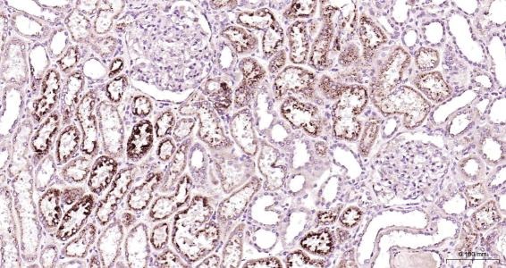 Anti-LAMP2 Polyclonal Antibody