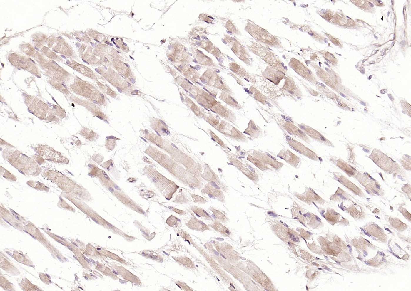 Anti-MFN1 Antibody (5U87)