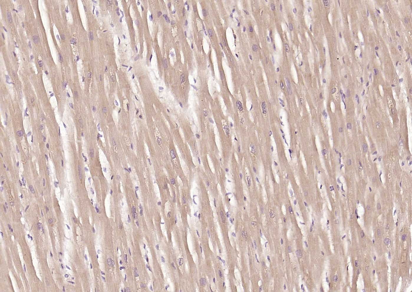 Anti-MFN1 Antibody (5U87)