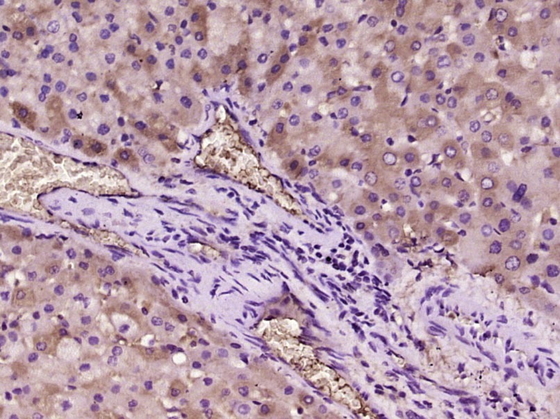 Anti-ox-LDL Polyclonal Antibody