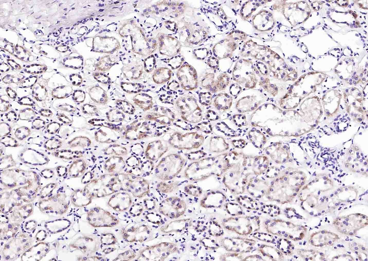 Anti-Phospho-AQP2 (Ser256) Polyclonal Antibody