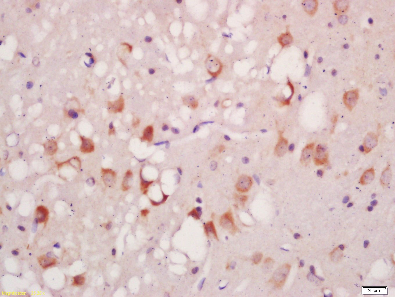 Anti-Phospho-ATG1 (Ser556) Polyclonal Antibody