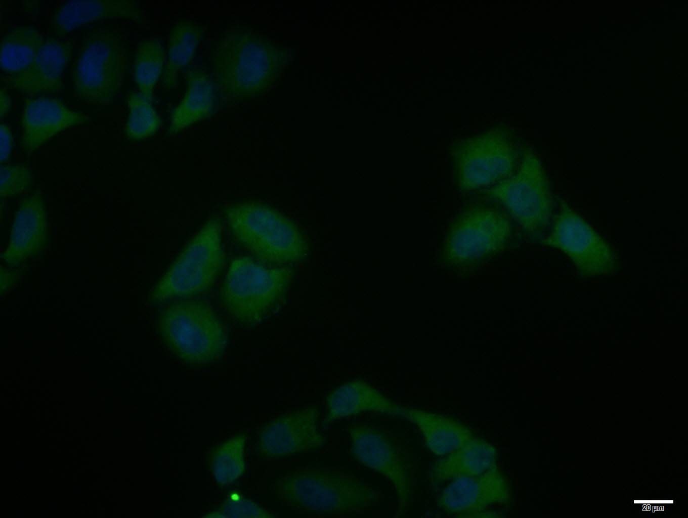 Anti-Phospho-IKBKA/IKBKB (Ser176, 180) Polyclonal Antibody