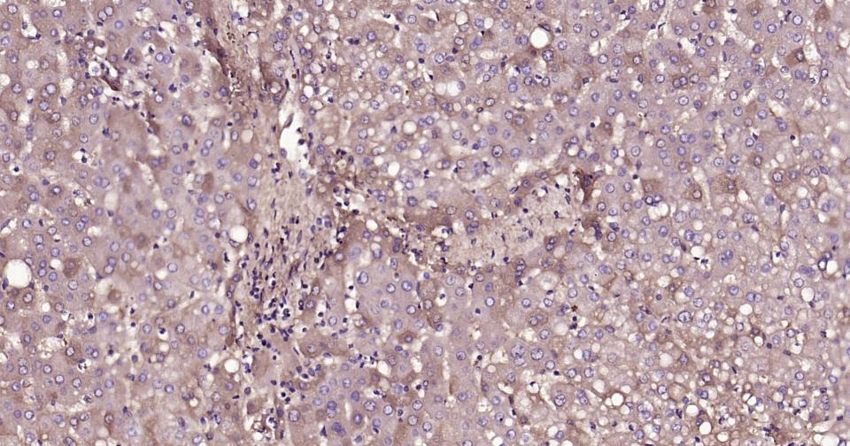 Anti-ox-LDL Polyclonal Antibody 2