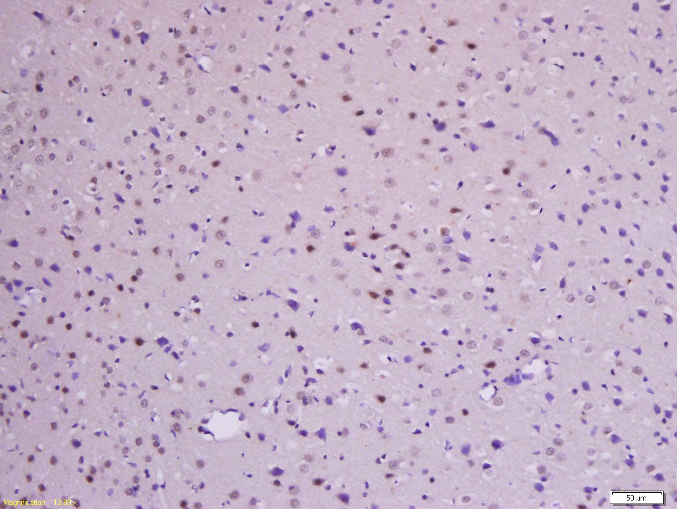 Anti-Phospho-Beta-Catenin (Ser33, 37) Polyclonal Antibody