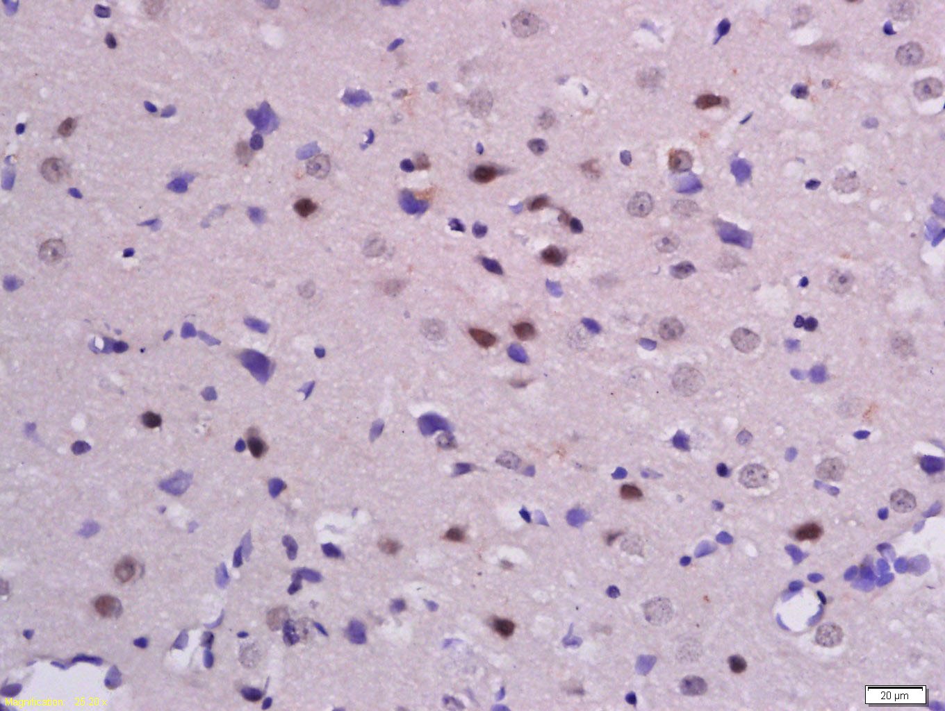 Anti-Phospho-Beta-Catenin (Ser33, 37) Polyclonal Antibody