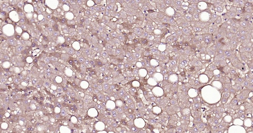 Anti-ox-LDL Polyclonal Antibody 2