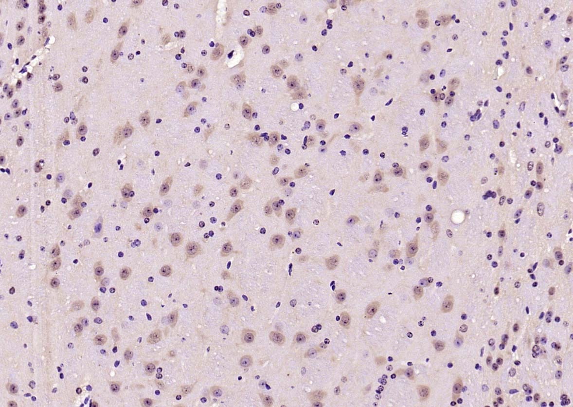 Anti-Phospho-AMPK alpha 2 (Thr172) Polyclonal Antibody