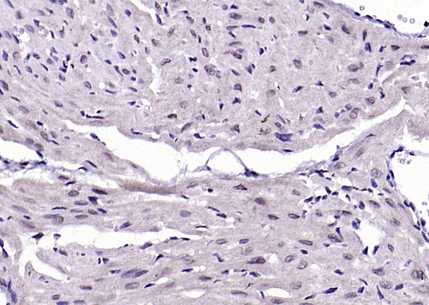 Anti-Phospho-IKBKB (Tyr199) Polyclonal Antibody