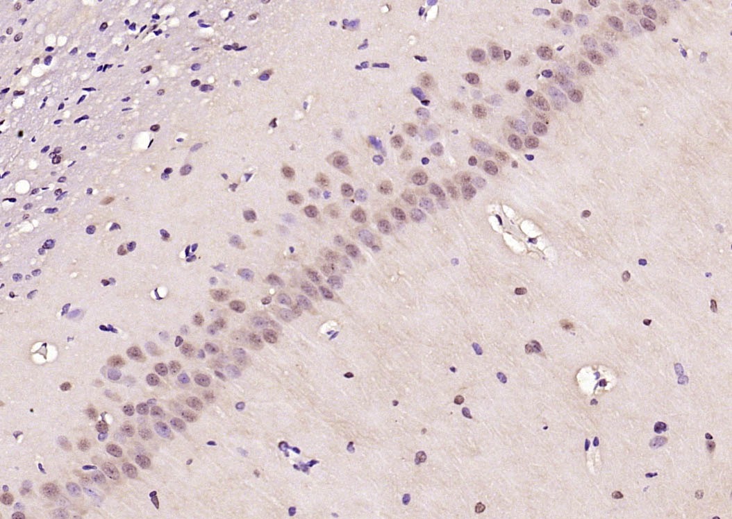 Anti-Phospho-AMPK alpha 2 (Thr172) Polyclonal Antibody