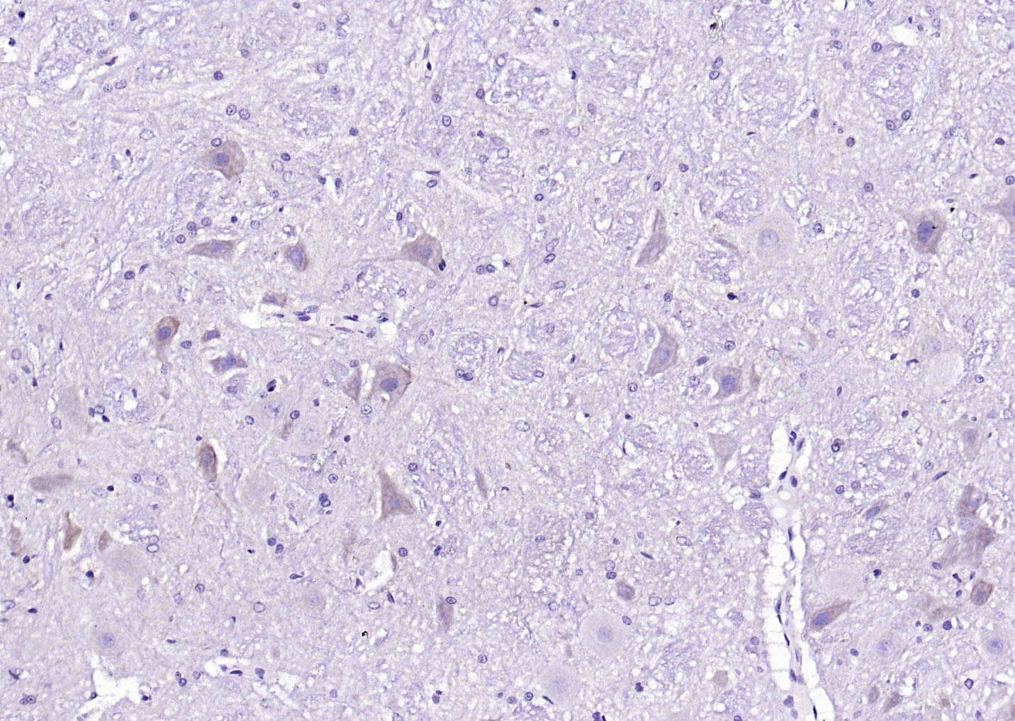 Anti-Phospho-CaMK2 alpha (Tyr230) Polyclonal Antibody