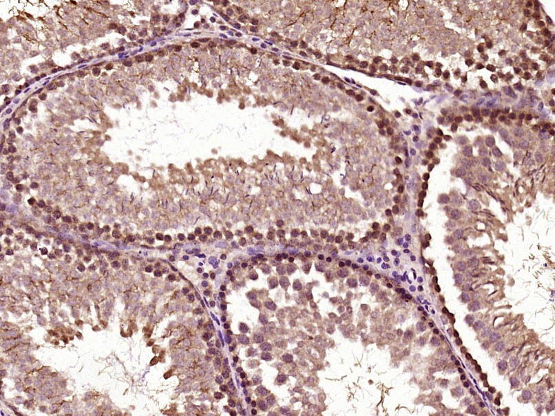 Anti-Phospho-BRAF (Ser365) Polyclonal Antibody
