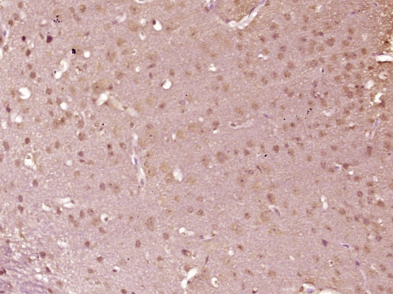Anti-Phospho-IKBKA/IKBKB (Ser176, 180) Polyclonal Antibody