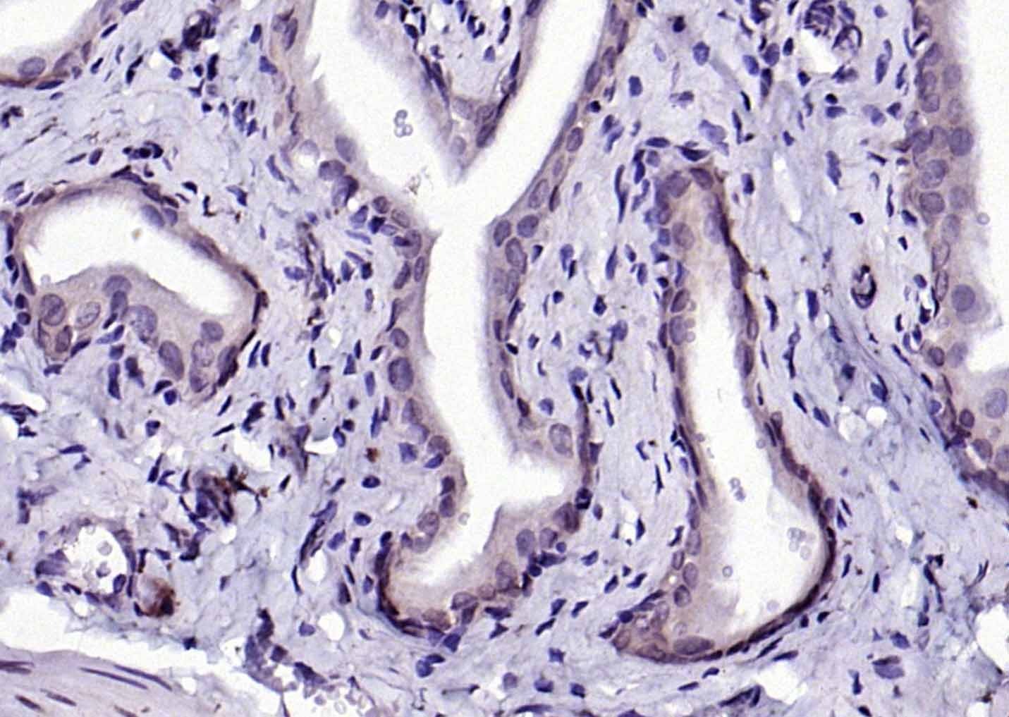 Anti-Phospho-IKBKB (Tyr199) Polyclonal Antibody