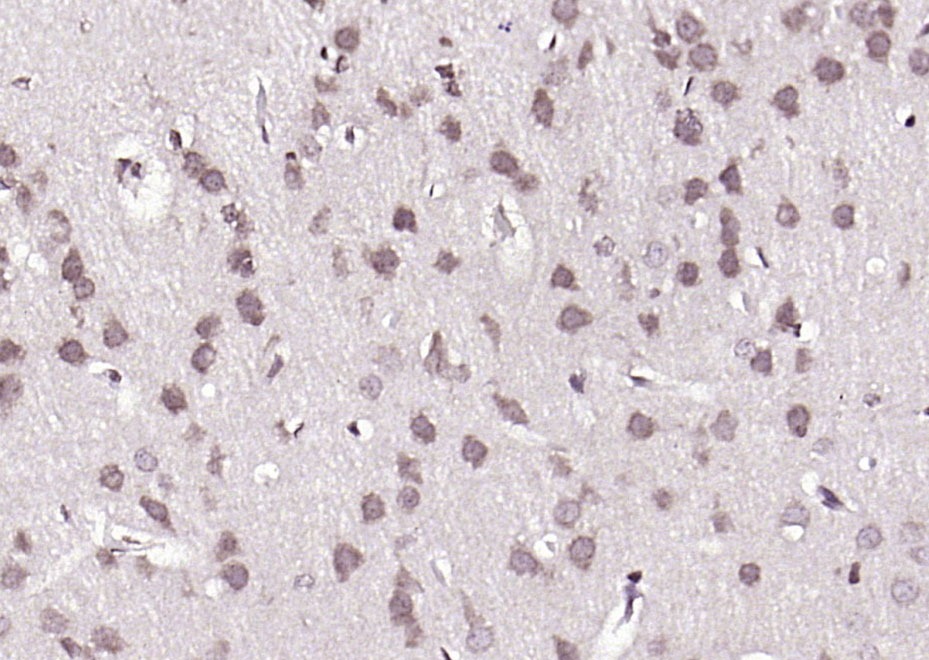 Anti-Phospho-BRAF (Ser365) Polyclonal Antibody