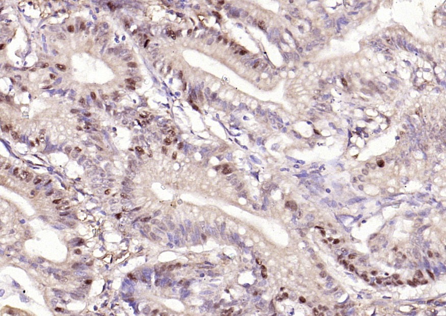 Anti-Phospho-Beta-Catenin (Ser33, 37) Polyclonal Antibody