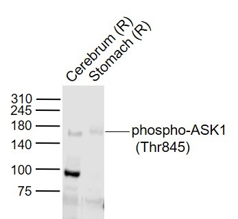 Anti-Phospho-ASK1 (Thr845) Polyclonal Antibody