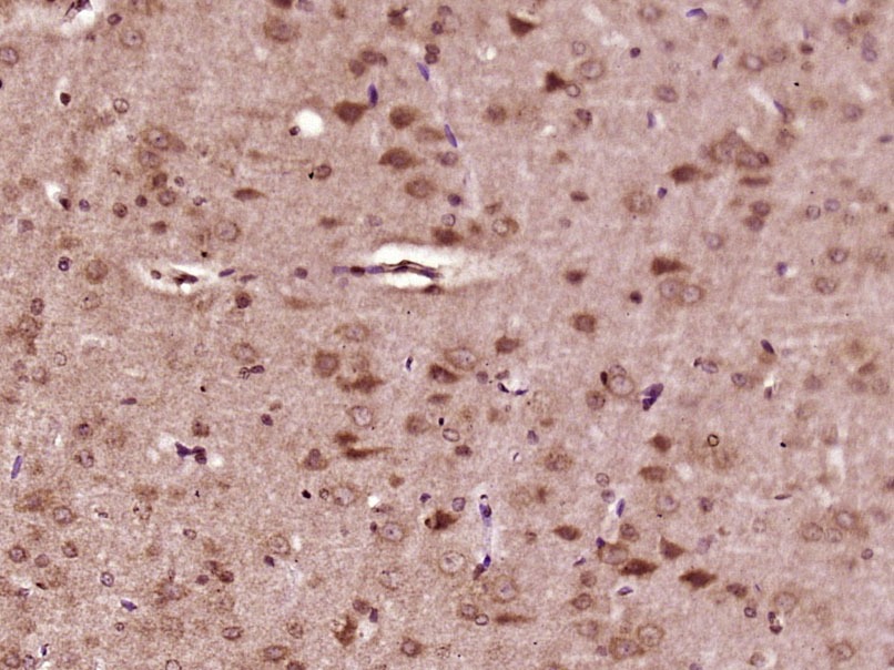 Anti-Phospho-BRAF (Ser365) Polyclonal Antibody