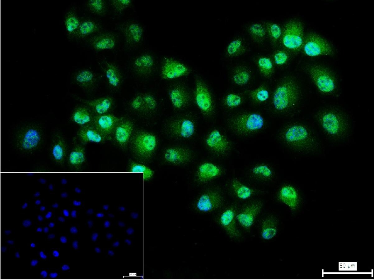 Anti-p53BP1 Polyclonal Antibody