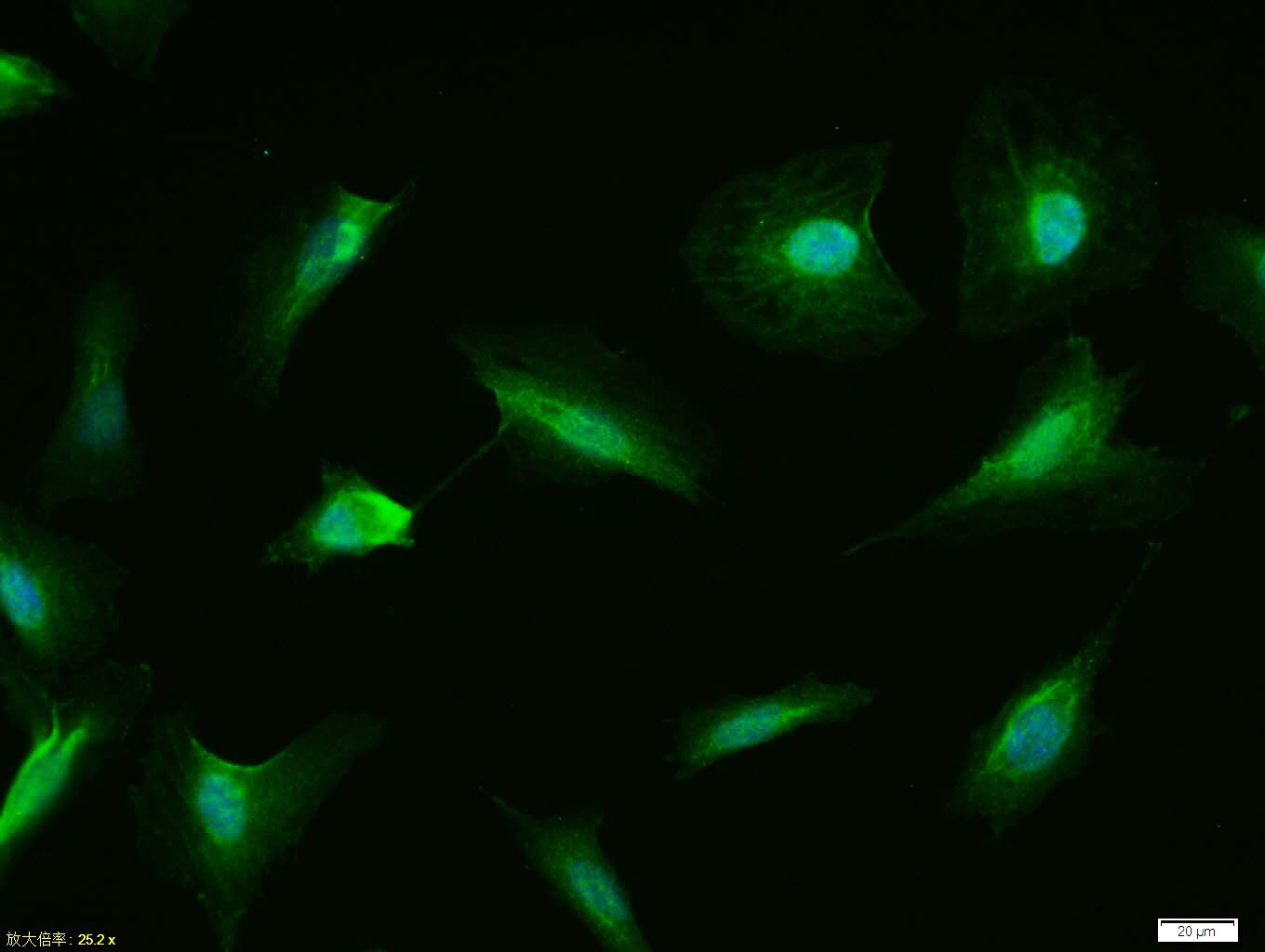 Anti-p53 Polyclonal Antibody 2