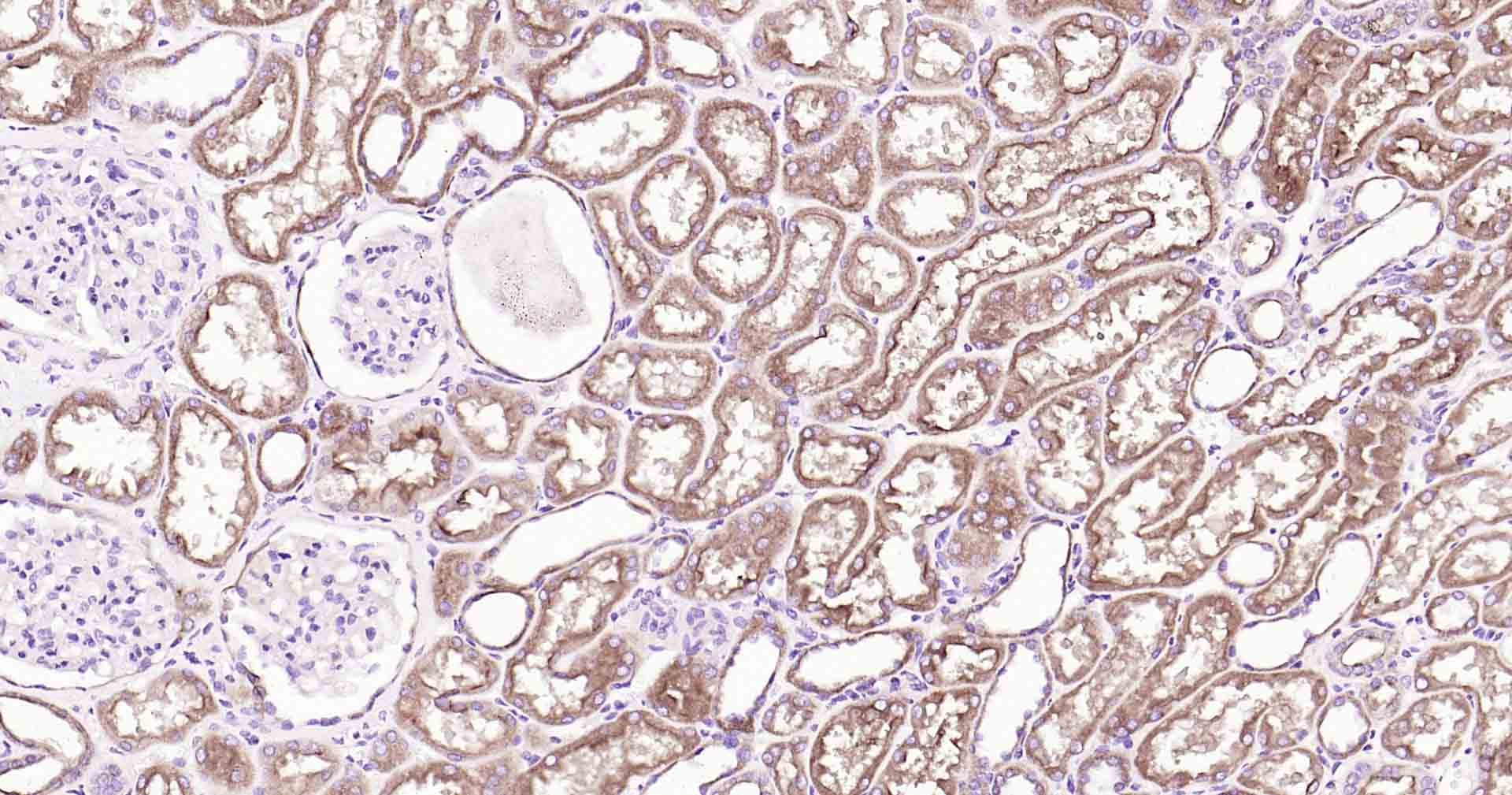 Anti-P Glycoprotein Antibody (1U603)