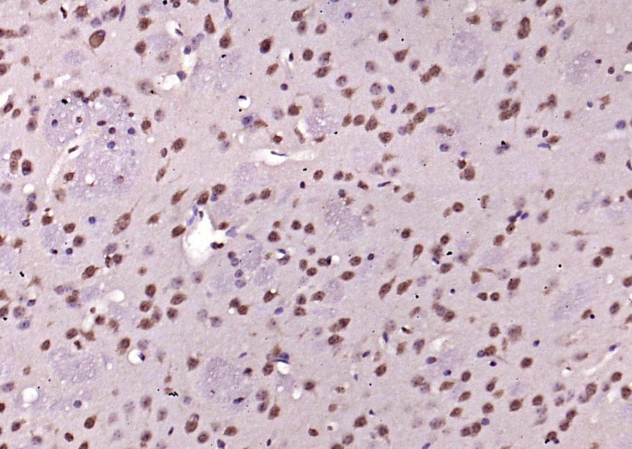 Anti-Phospho-ERK1 (Thr202 , Tyr204) Polyclonal Antibody