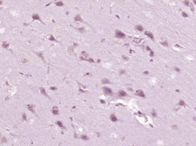 Anti-Phospho-CaMKII (Thr287) Polyclonal Antibody