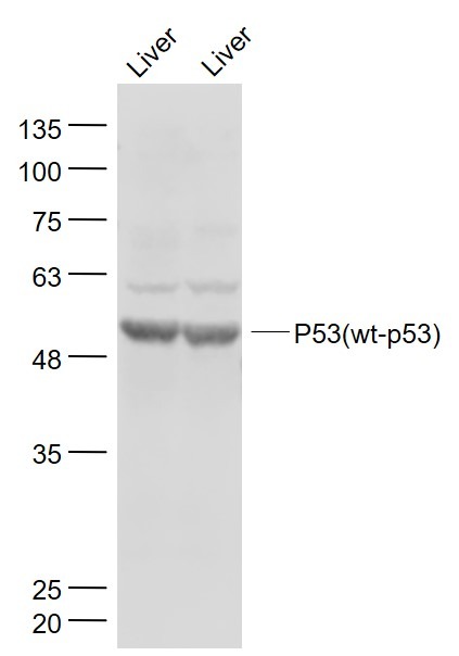 Anti-p53 Polyclonal Antibody 2