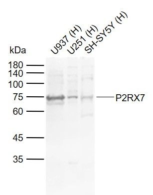 Anti-P2RX7 Polyclonal Antibody