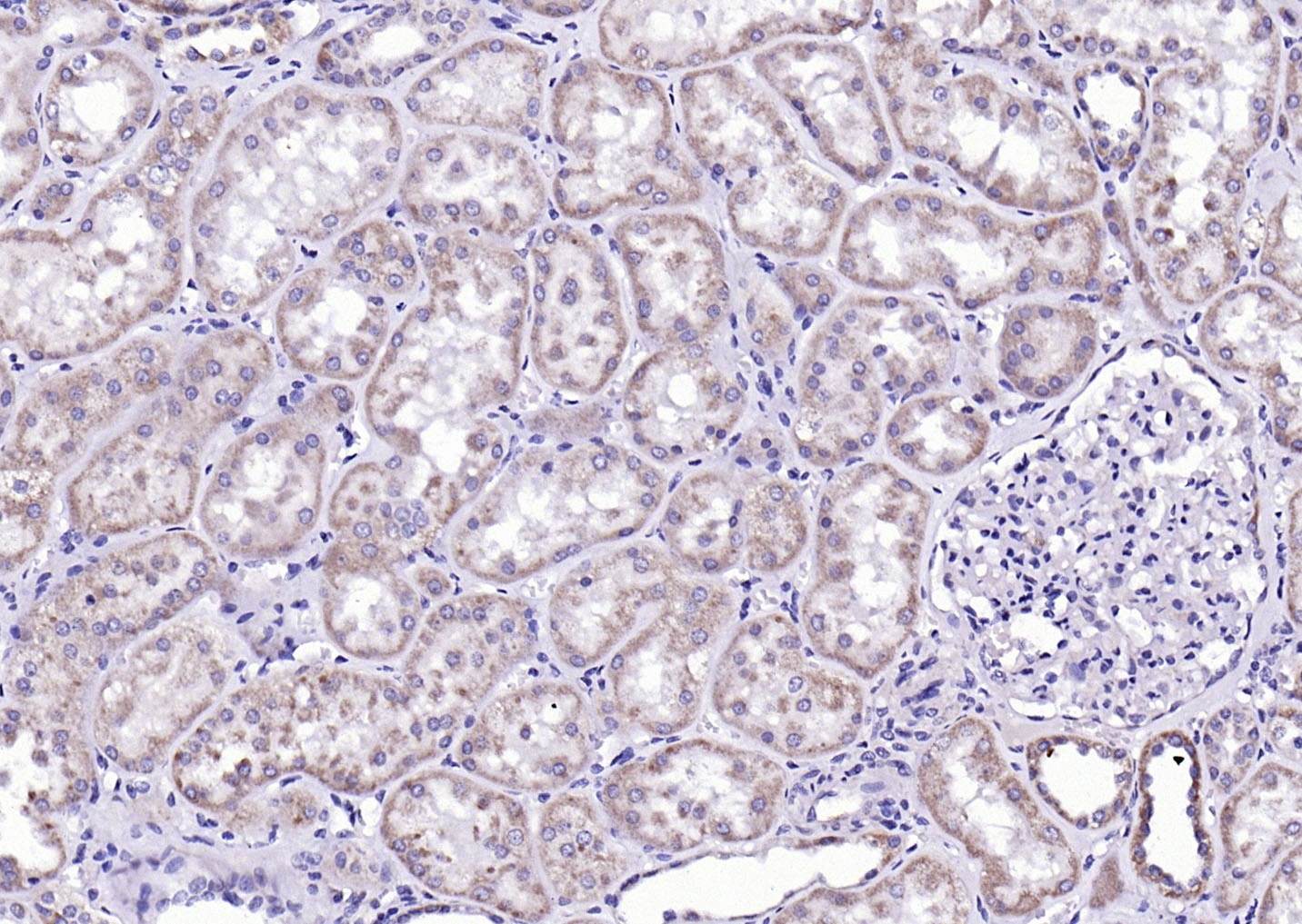 Anti-Phospho-CaMK2 alpha (Tyr230) Polyclonal Antibody