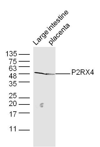 Anti-P2RX4 Polyclonal Antibody