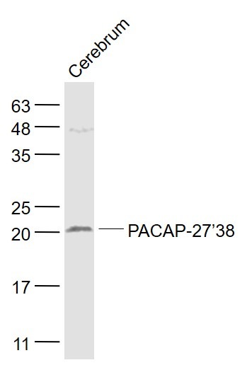 Anti-PACAP-27/38 Polyclonal Antibody