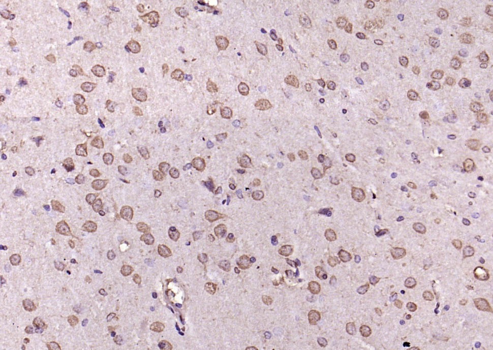 Anti-Phospho-ERK1 (Thr202 , Tyr204) Polyclonal Antibody