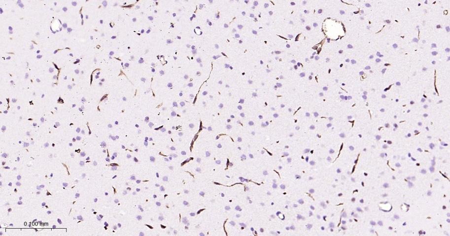 Anti-P Glycoprotein Antibody (1U603)