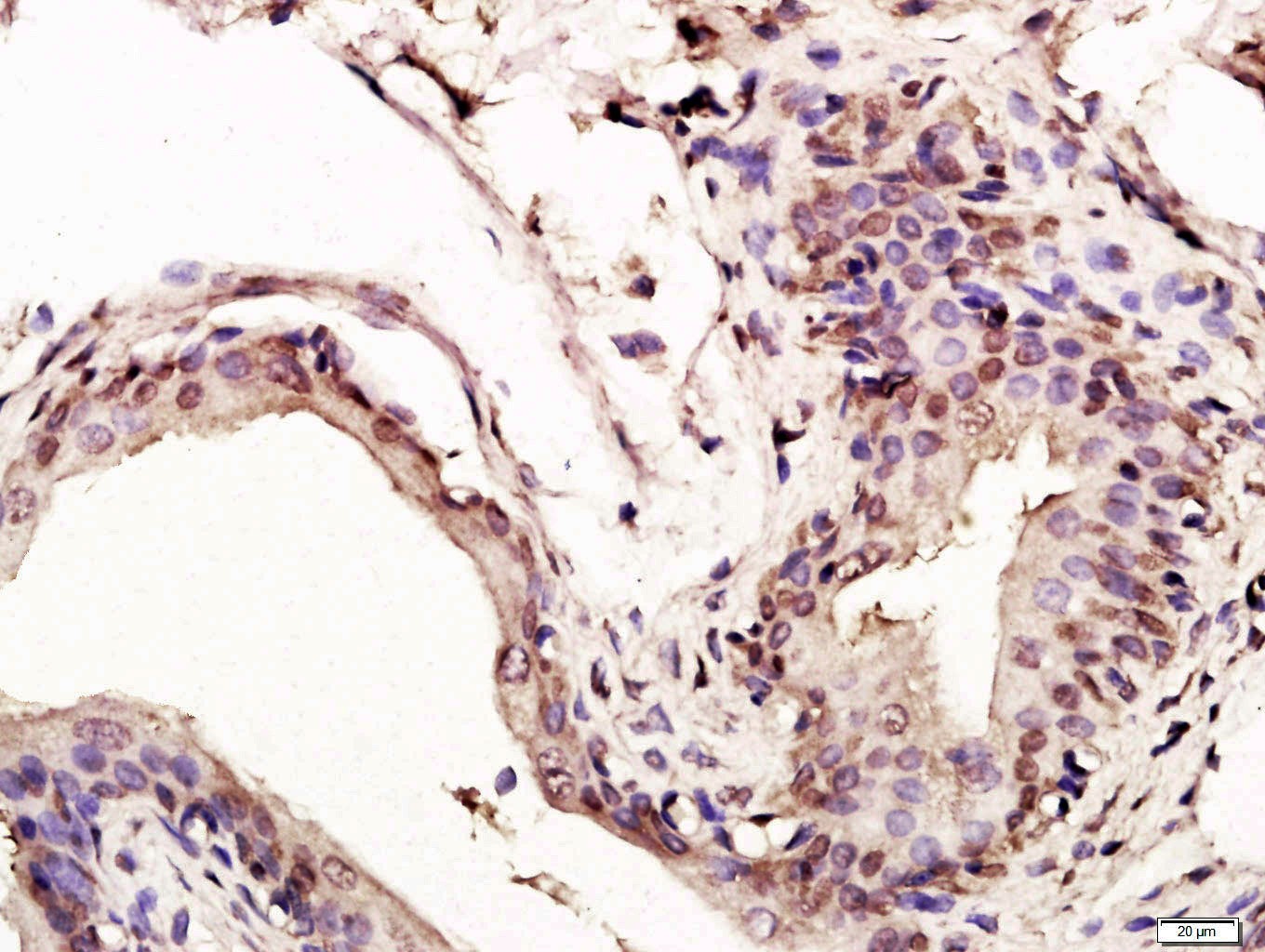 Anti-p53 Polyclonal Antibody 3