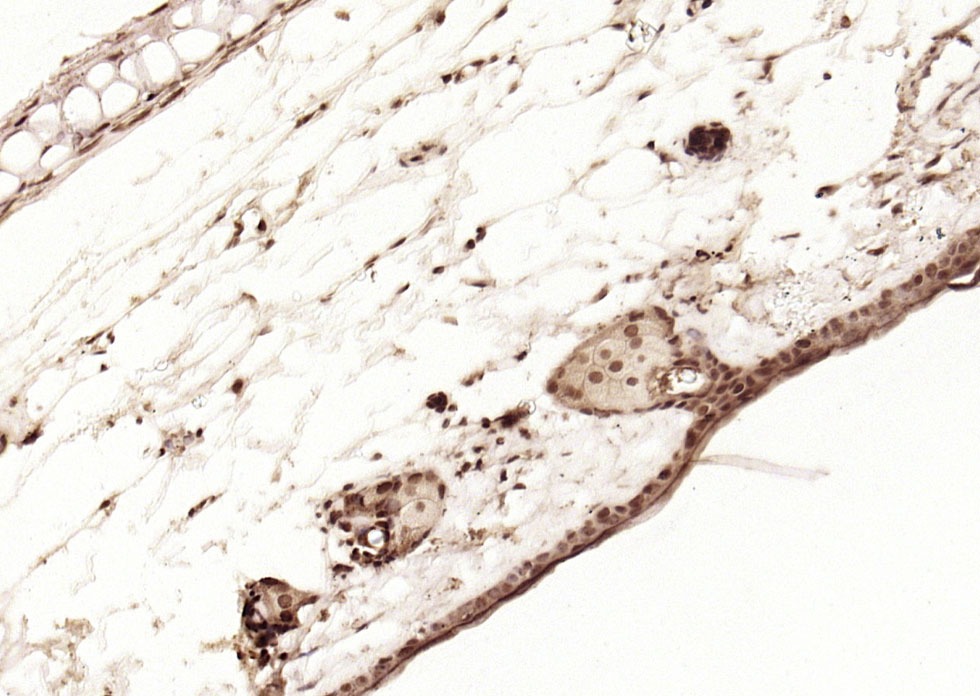 Anti-p53 Polyclonal Antibody 3