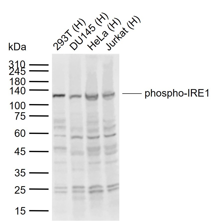 Anti-Phospho-IRE1 (Ser724) Polyclonal Antibody
