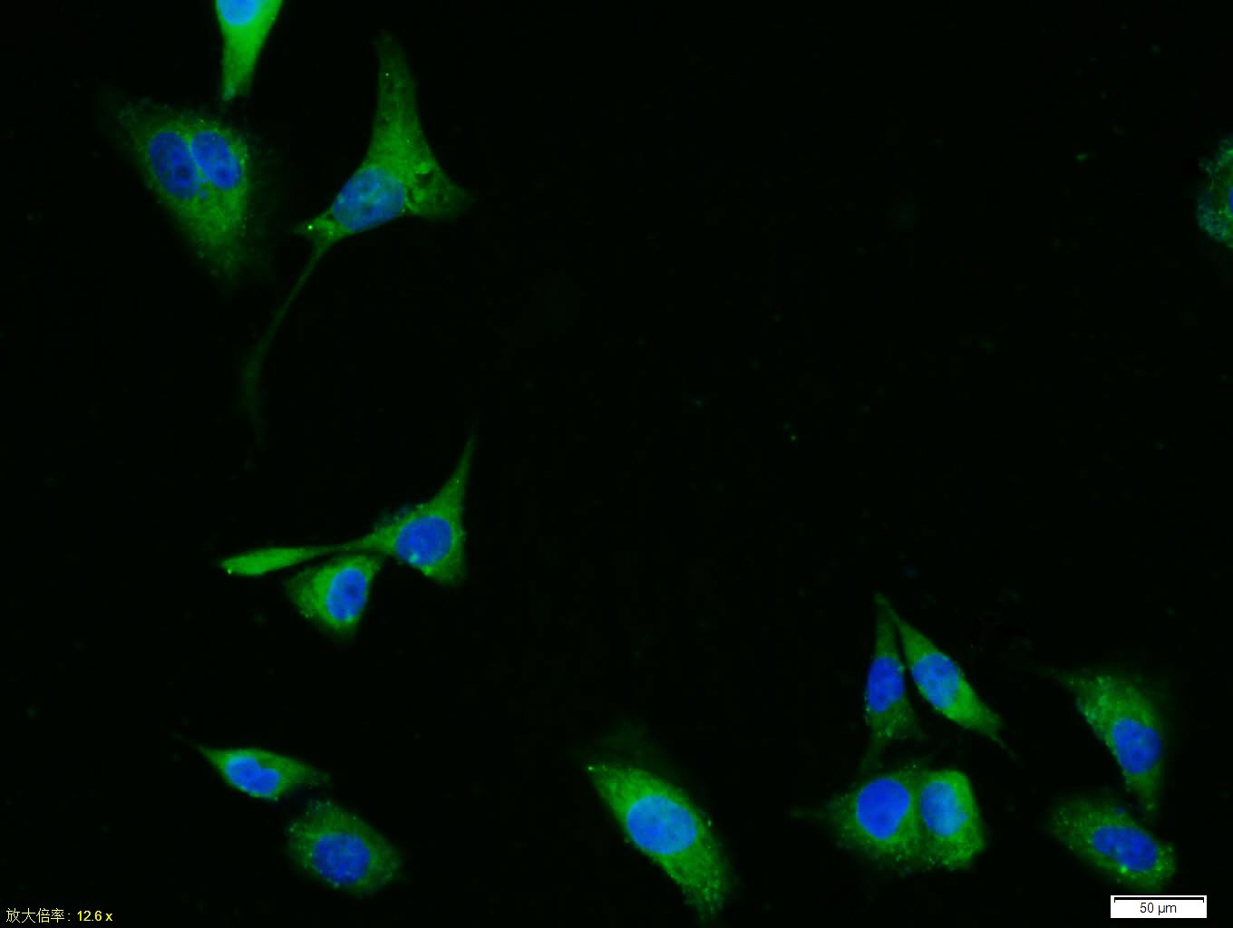 Anti-Phospho-ERK1/2 (Thr183, Tyr185) Polyclonal Antibody
