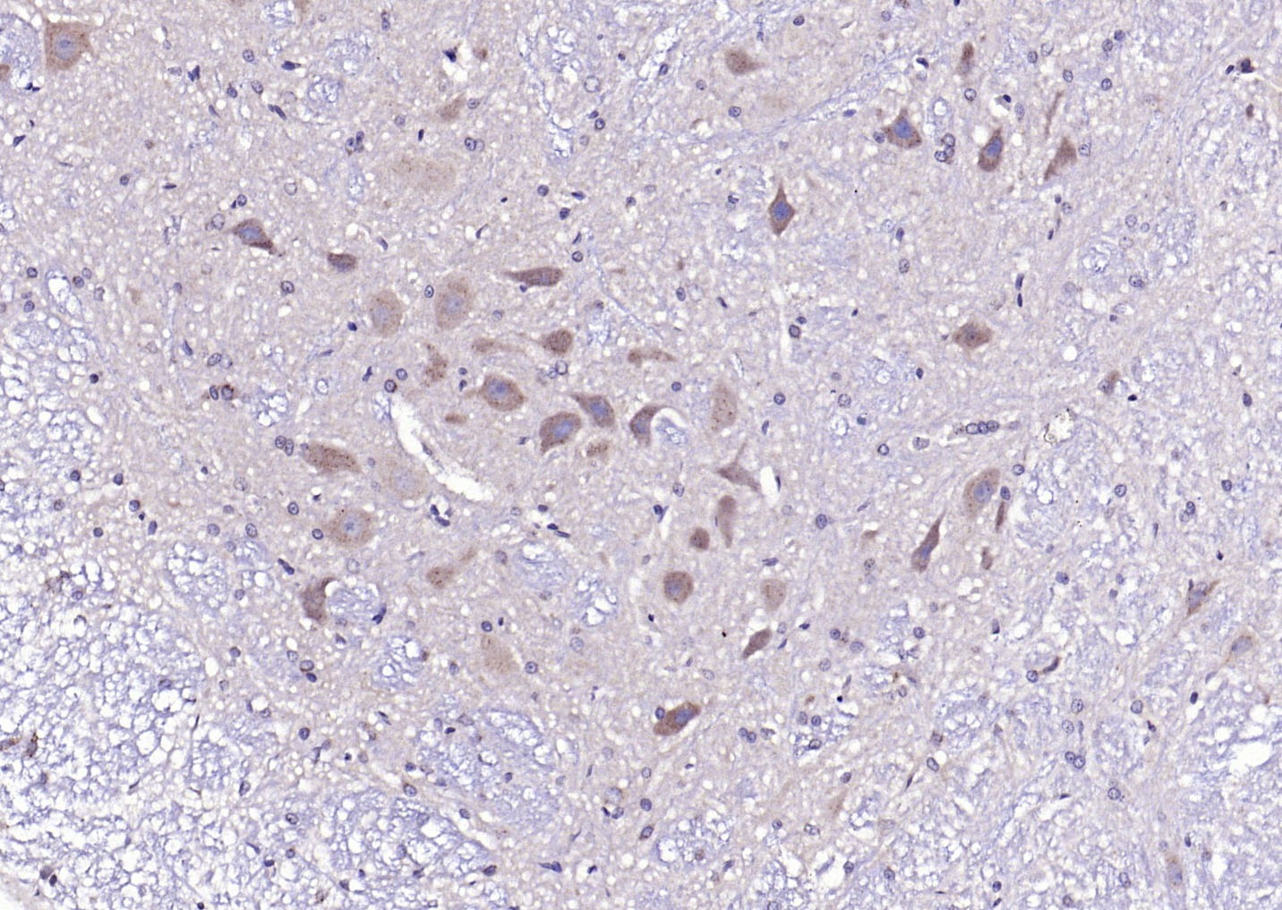 Anti-Phospho-CaMKII (Thr287) Polyclonal Antibody
