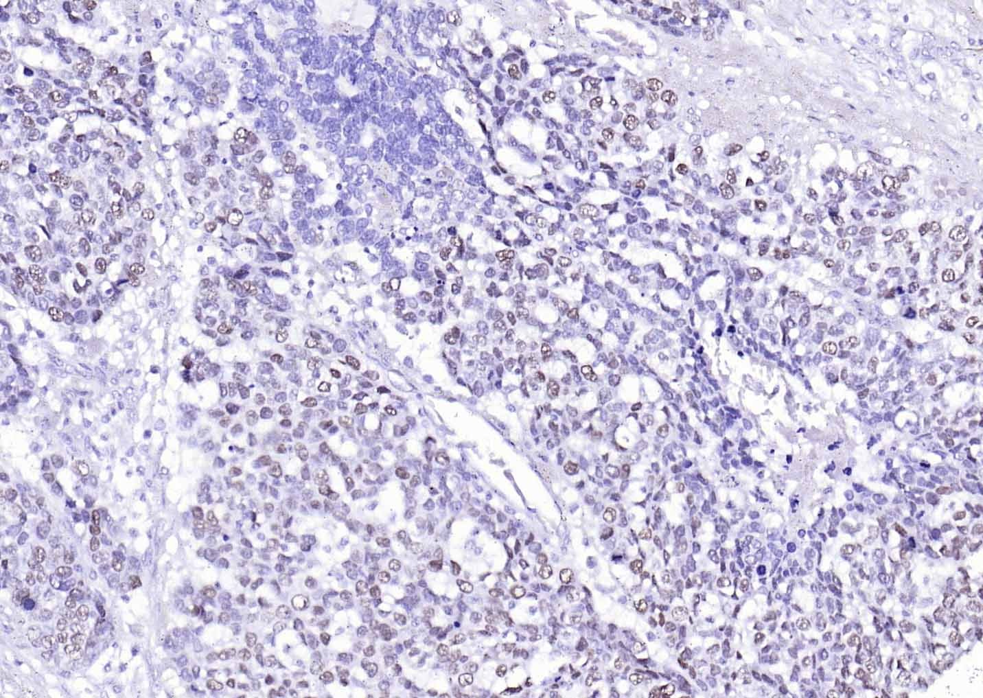 Anti-p53 Antibody (7T648)