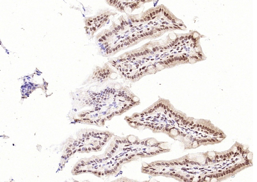 Anti-p53 Polyclonal Antibody 3