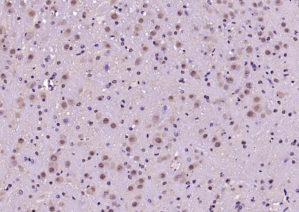 Anti-Phospho-FOXO1 (Ser319) Polyclonal Antibody