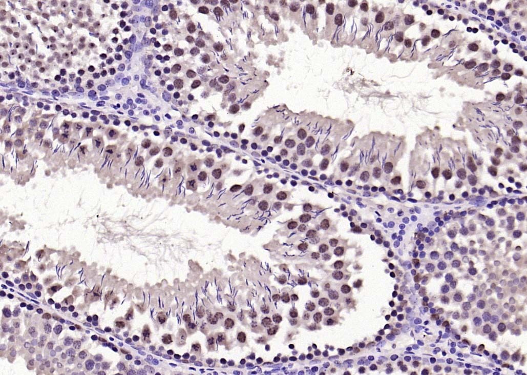 Anti-Phospho-FOXO1 (Ser319) Polyclonal Antibody