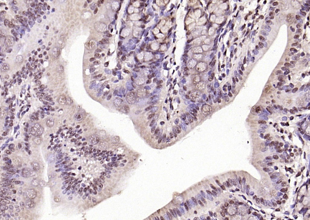 Anti-Phospho-FOXO1 (Ser319) Polyclonal Antibody