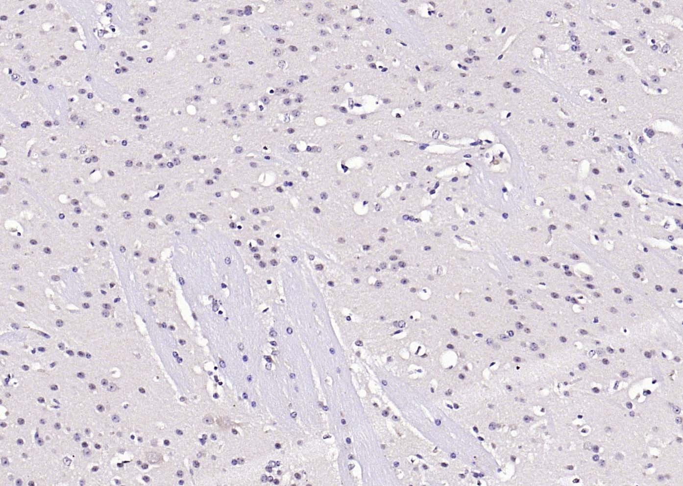 Anti-Phospho-AKT (Ser473) Antibody (9L992)