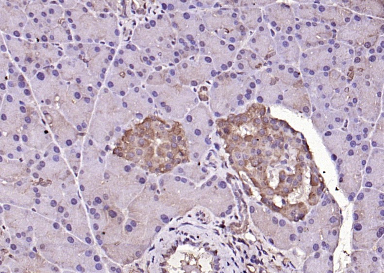 Anti-Phospho-ERK1/2 (Thr202 , Tyr204) Polyclonal Antibody